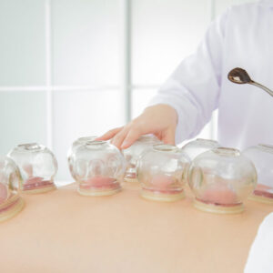 Clinical Cupping Therapist