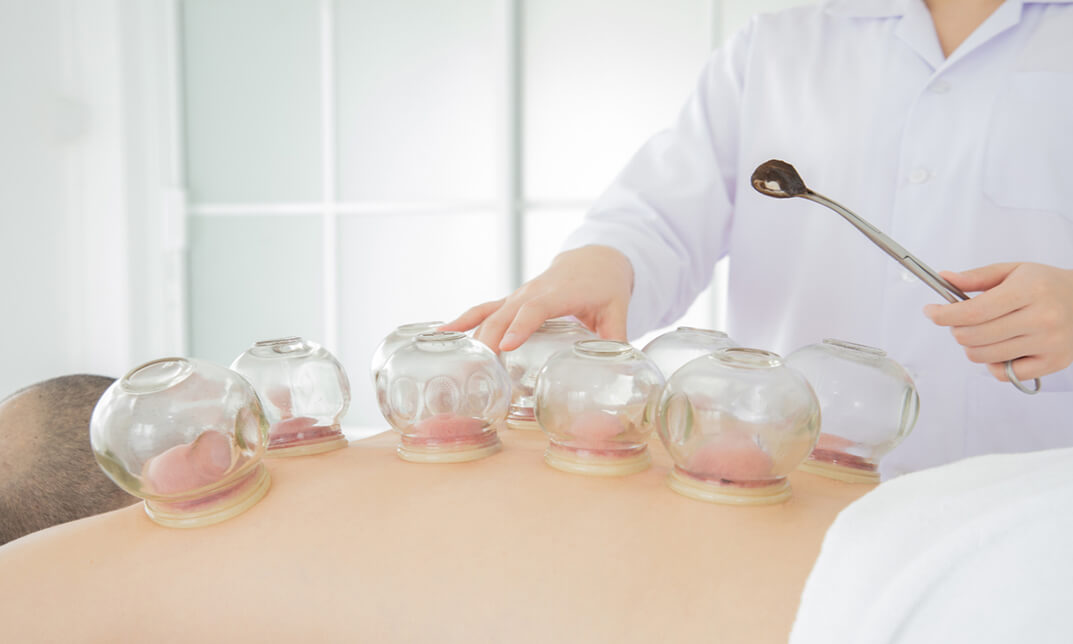 Clinical Cupping Therapist
